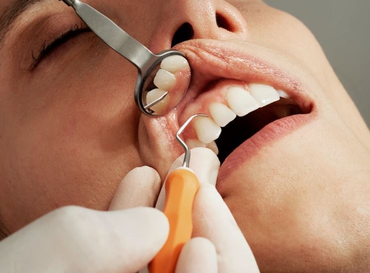 How bad oral hygiene can lead to oral cancer? 