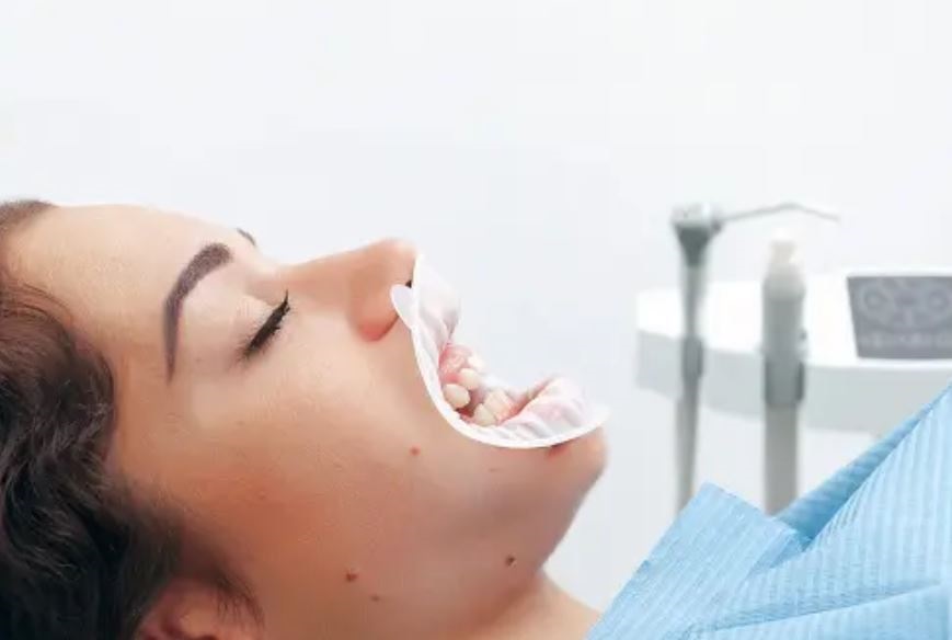 Harley Street's Influence on Cosmetic Dentistry: A Legacy of Excellence