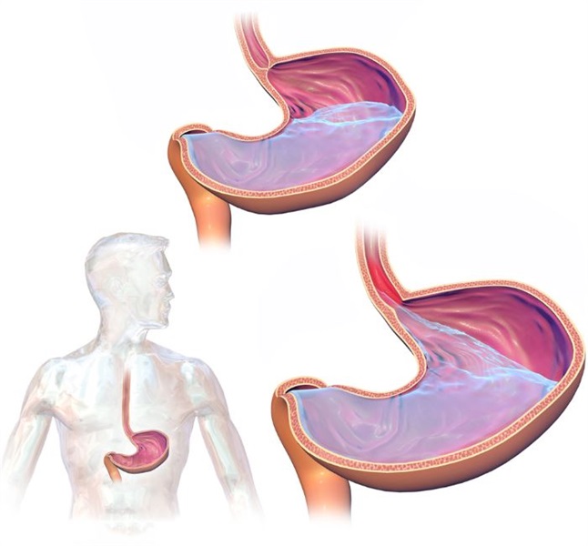 How To Stop The Burning: A Guide To Prevent And Treat GERD