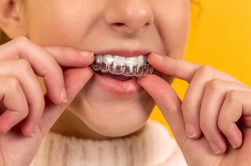 What will dental implants cost?