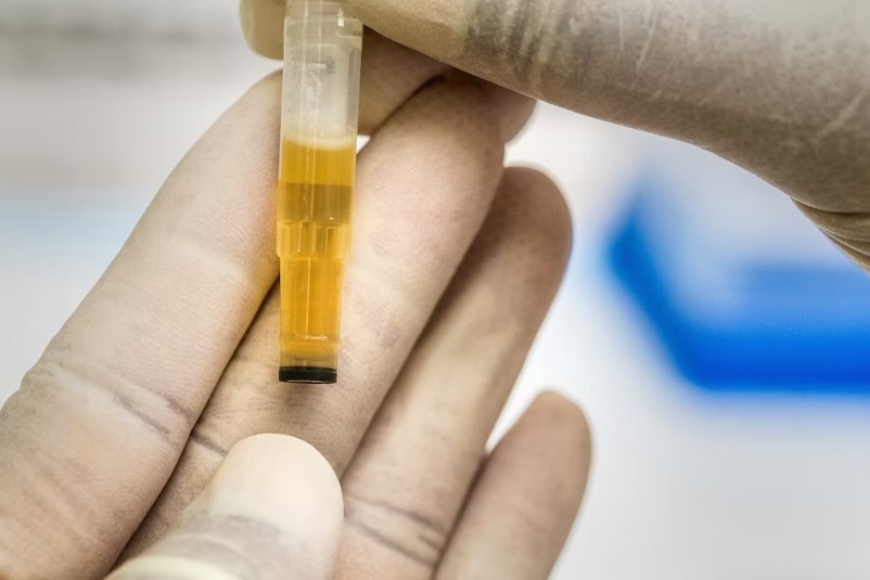 Understanding Synthetic Urine: A Comprehensive Guide for Various Uses