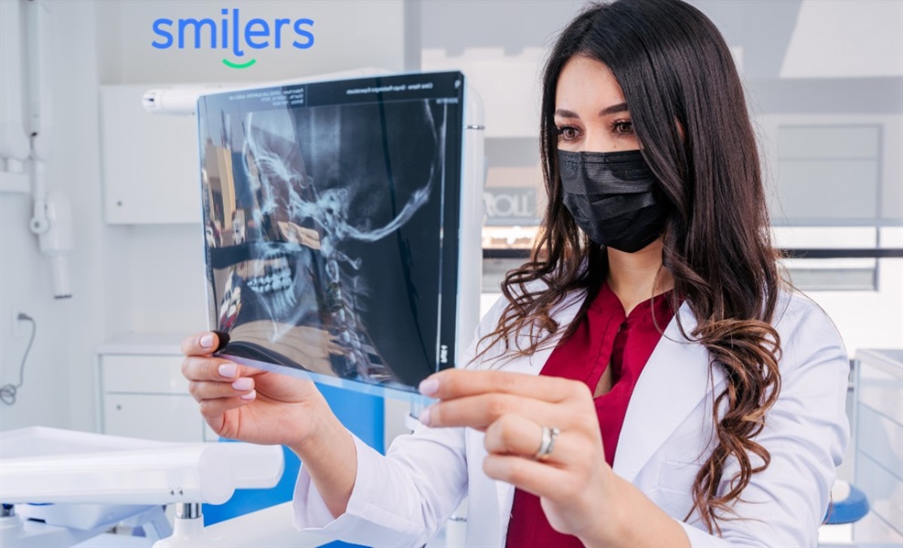 Considering Dental Implants in Mexico? A Comprehensive Guide