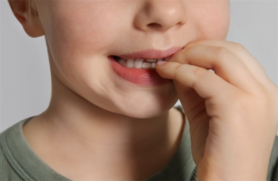 5 Parenting Tips to Prevent Necrotic Teeth in Toddlers