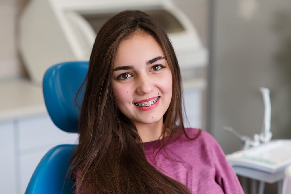 The Relationship between Overbite Severity and Treatment Planning