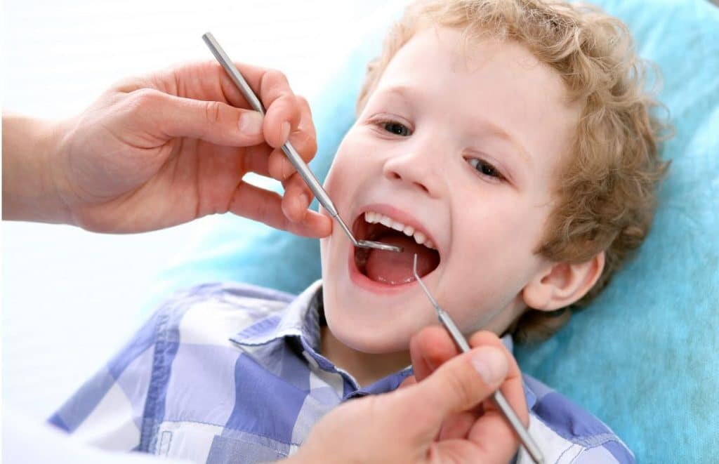 Dental Sealants for Children and Teens: How They Prevent Cavities on Molars