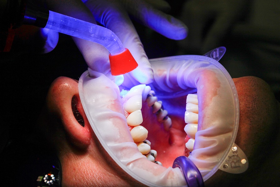Key Ways to Improve Your Dental Health