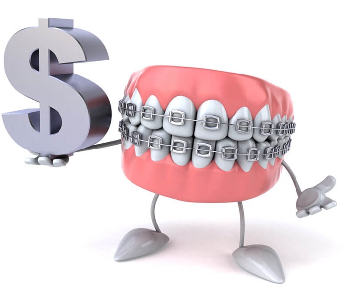 Why are braces so expensive?