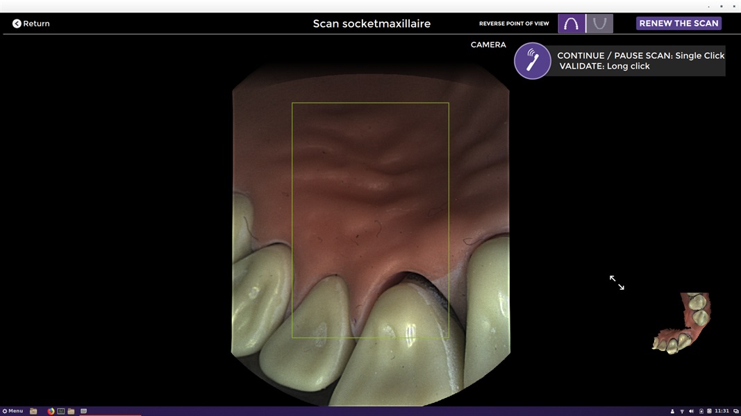 Accurate, digital impression scans