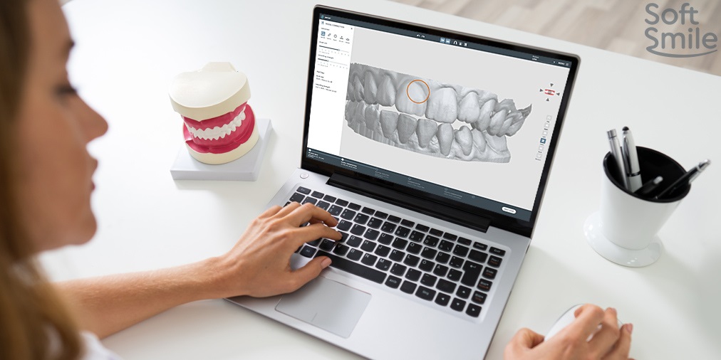 Three Ways AI is Transforming the Dental Aligner Market