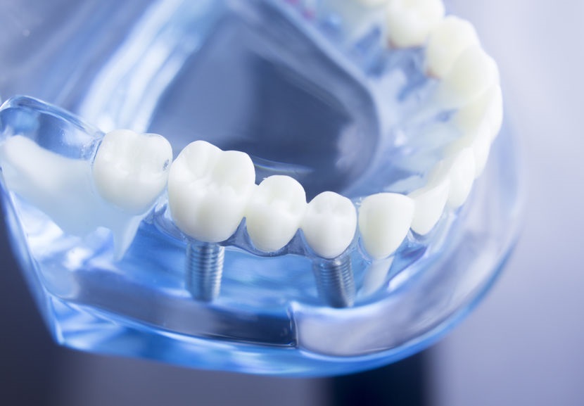 Tips for Maintaining Healthy Teeth through Dental Technology