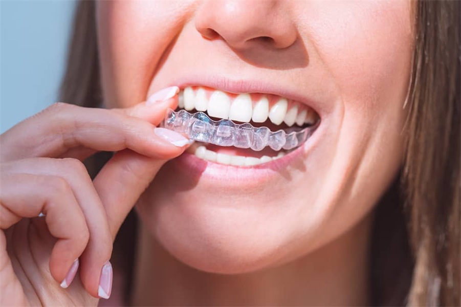  How Long Is Invisalign® Treatment?