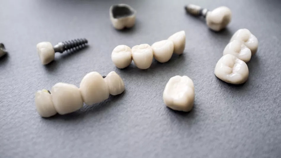 Soft Tissue Management Around Implants: Simple Steps That Make A Big Difference