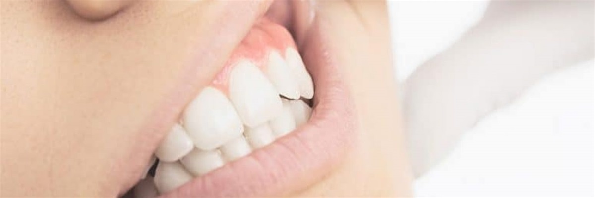 How to Choose the Right Periodontist: 10 Tips for Finding the Best One