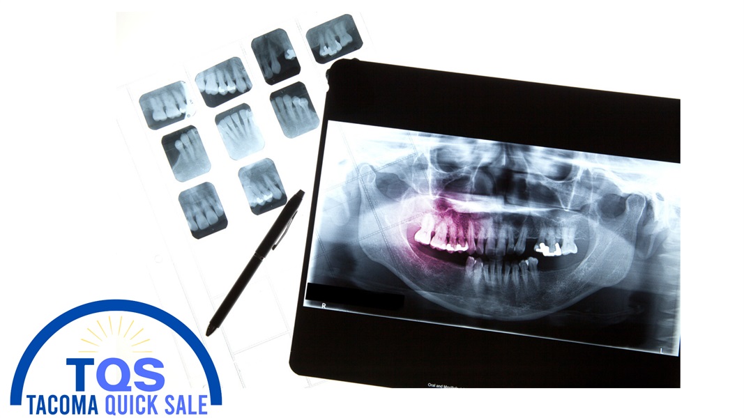 X-ray recycling and old Panoramic disposal guide