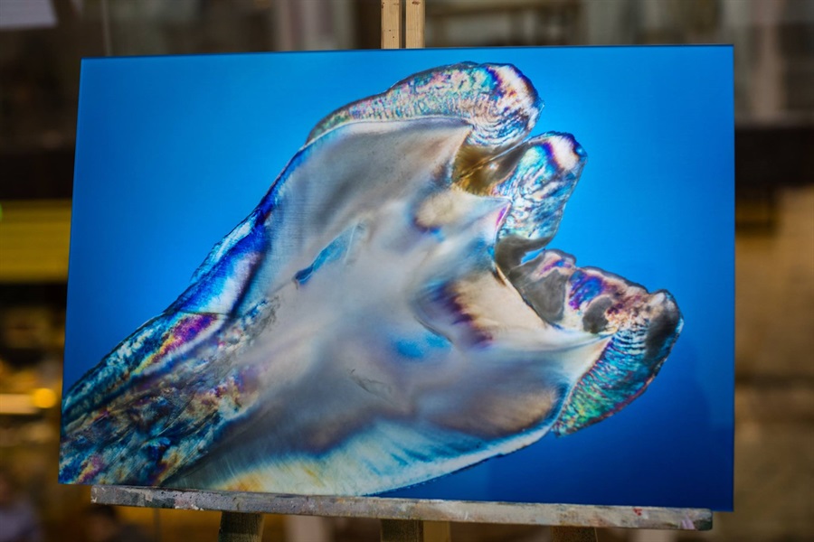 The   One-Time   Socket   Abutment Just    For   Incisor