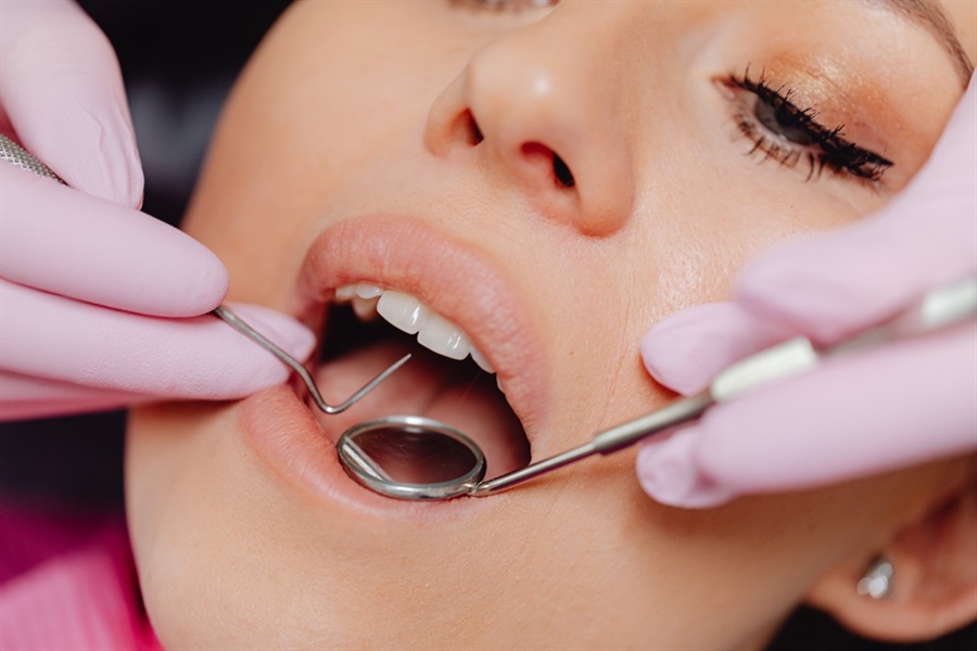 Why You Must Get a Professional Teeth Cleaning Service