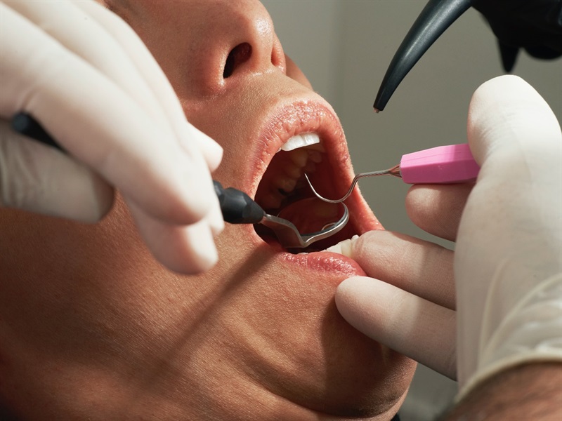 8 Red Flags in a Dentist That You Shouldn't Miss