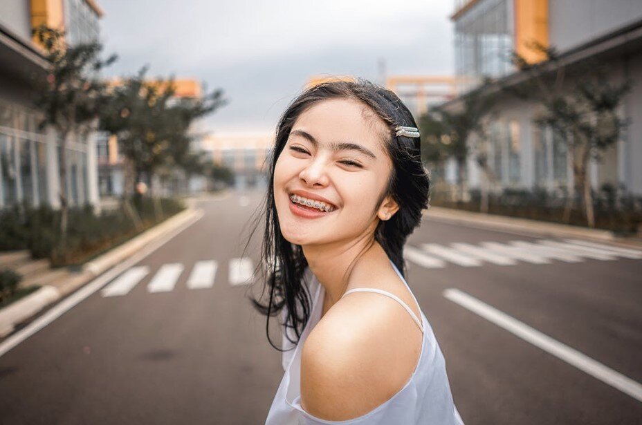 What to Know About Affordable Orthodontic Options