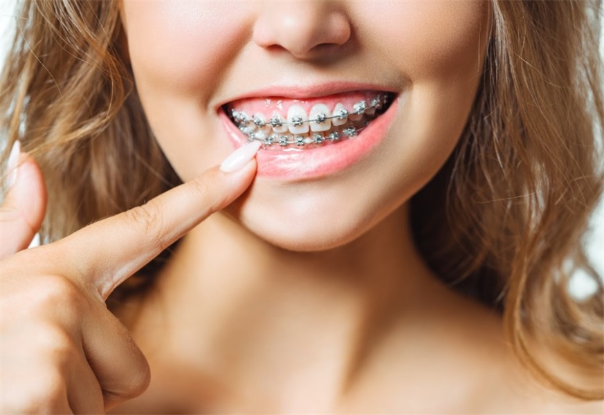 Orthodontic Treatment Options: What You Need To Know