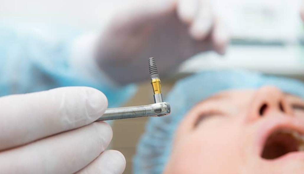 Supporting Post-Dental Surgery Recovery at Home: The Role of Hospital Beds in Comfort and Healing