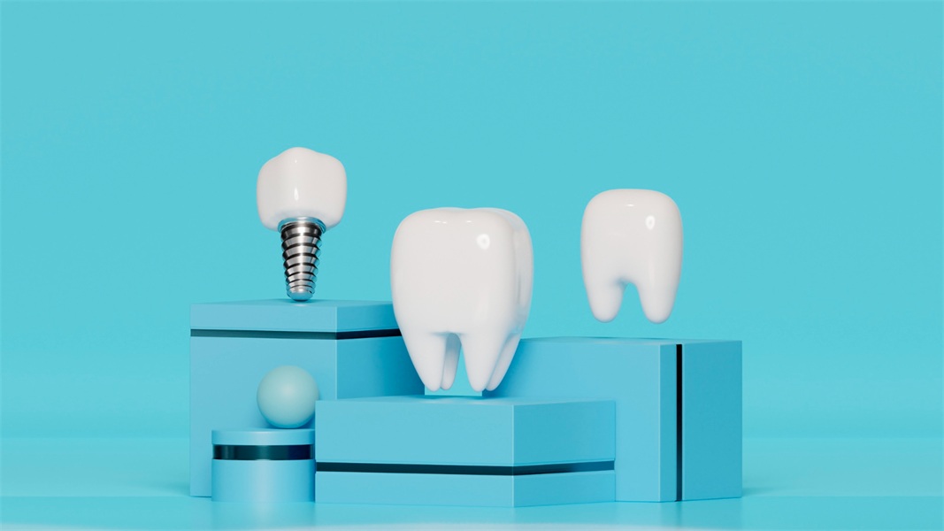 Why Dental Implants Are the Gold Standard for Replacing Missing Teeth