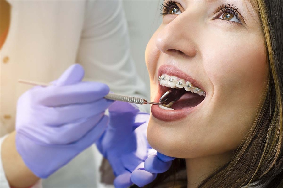 A Complete Guide to Braces Prices in Lahore by Your Trusted Dental Clinic