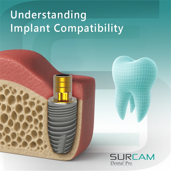 Understanding Dental Implant Compatibility: Key Insights for Clinicians