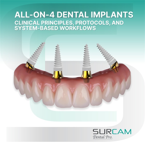 All-on-4 Dental Implants: Clinical Principles Behind the Protocol
