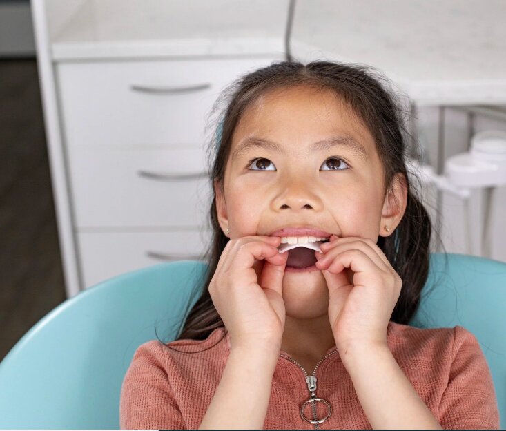 Beyond Straight Teeth: The Benefits of a Palatal Expander