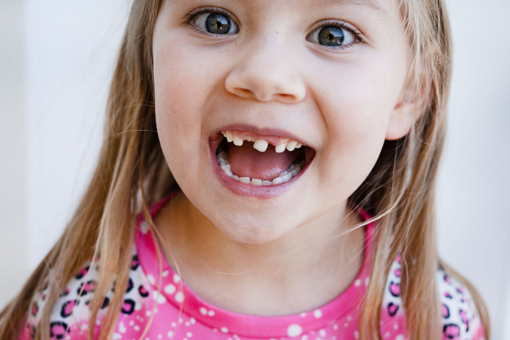 When a Baby Tooth Gets a Cavity: Treatment Options Parents Should Know