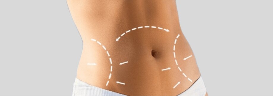 Which Country Is Best for Abdominoplasty?