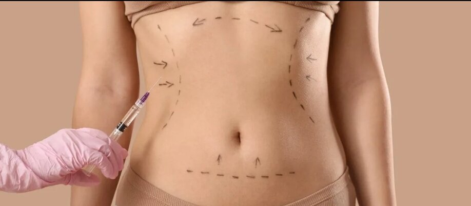 Which Country Is Best for Abdominoplasty?