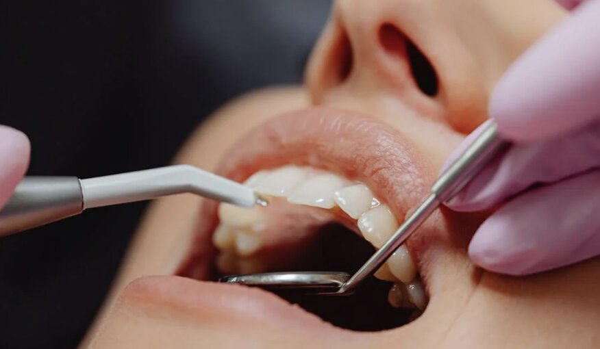 Can’t Chew Comfortably? How Full Mouth Rehabilitation Fixes Severe Dental Issues