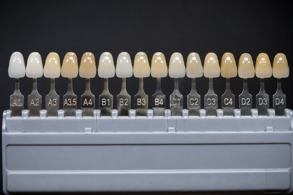 How dentists can improve crown case communication with their dental lab
