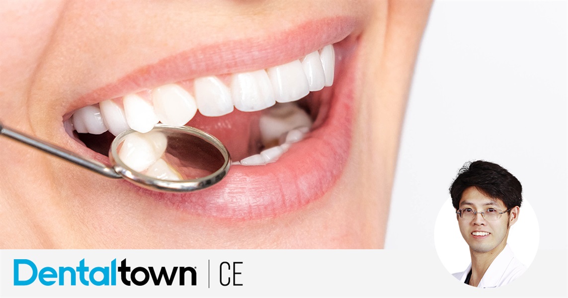 Esthetics For Veneers by Dr. Zhouyu Ding