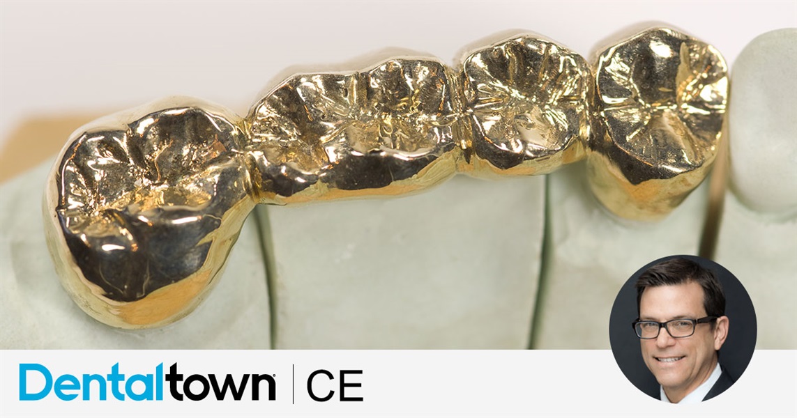 Aesthetic Conservative Cast Gold Restorations by Dr. Richard G. Stevenson III