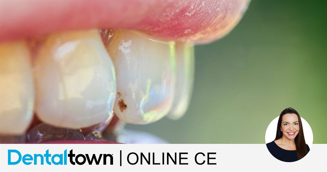 White Spot, What Now? An Update on Incipient Caries Treatments