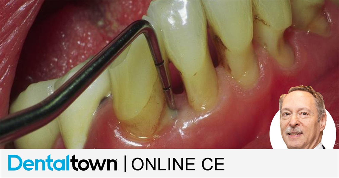 Diode Lasers in Periodontal Pocket Therapy by Dr. Bob Convissar